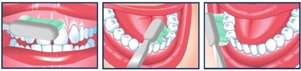 Zahnbürste richtig verwenden schräg an Zahnfleisch-setzen Tipps 