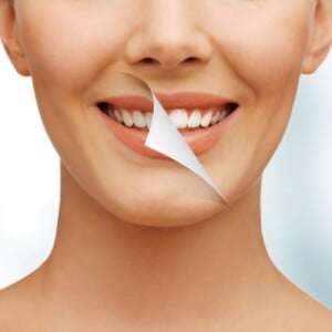 mittel-Zahnaufhellung-zu-hause-natuerliche-methoden