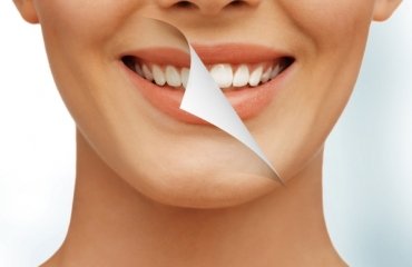 mittel-Zahnaufhellung-zu-hause-natuerliche-methoden