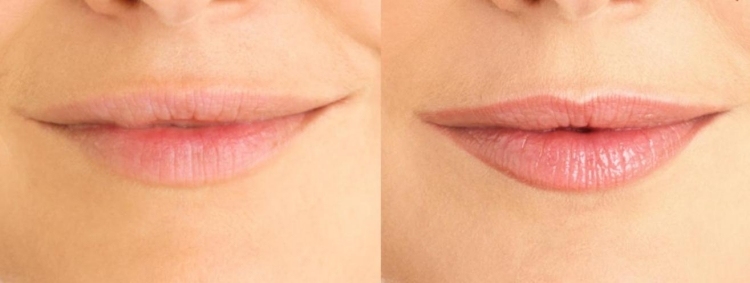 permanent-make-up-lippen-vorher-nachher-bilder-kontur