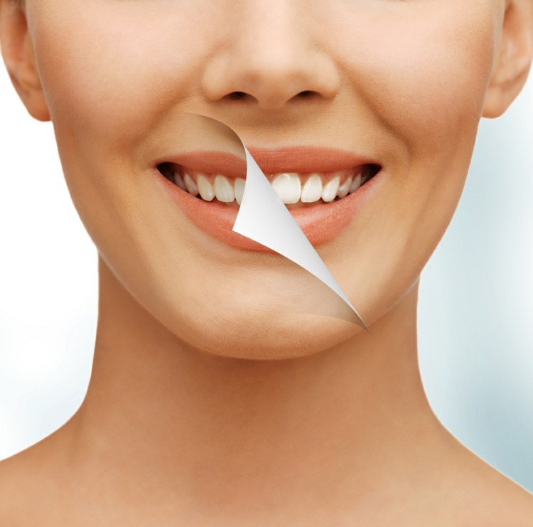 weiße zähne bekommen verfärbung-vorbeugen-tipps-gesunde-zähne