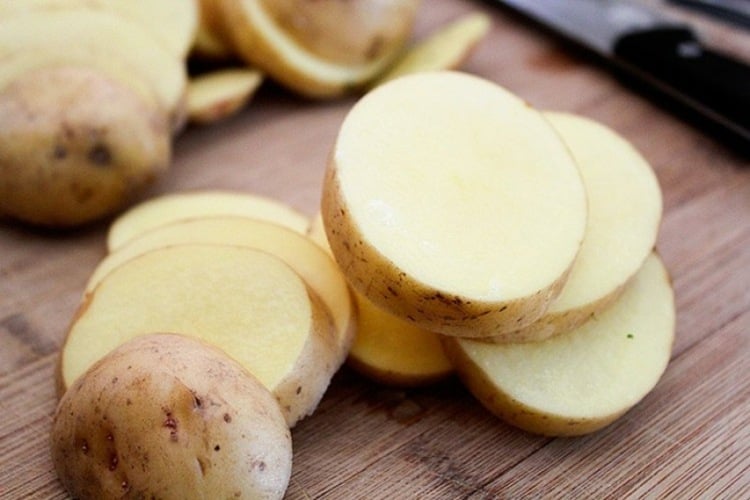 hausmittel-zahnschmerzen-kartoffelscheiben-kartoffelschale-messer-schneidebrett