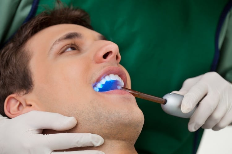mann-zahnaufhellung-behandlung-zahnarztpraxis
