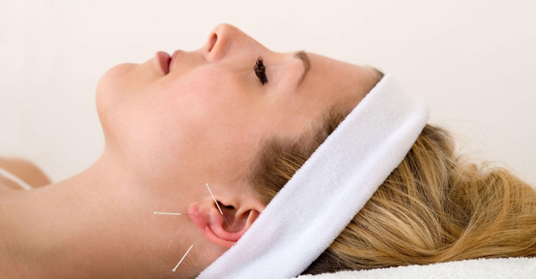 Abnehmen mit Akupunktur am Ohr