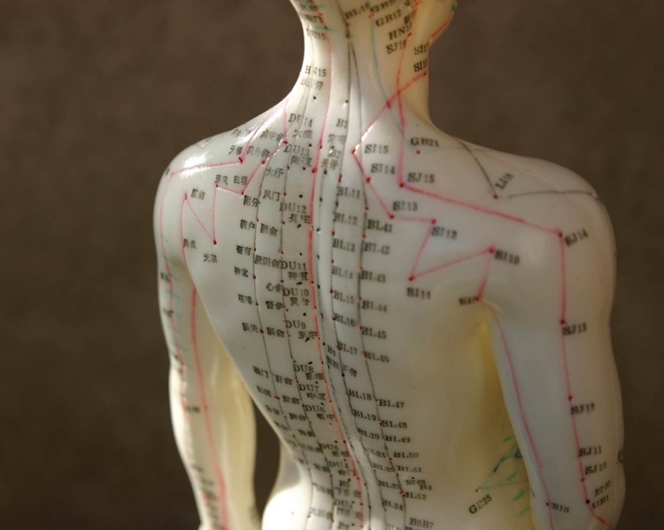 Abnehmen mit Akupunktur welche Punkte