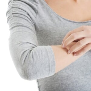 Allergie gegen Mückenstiche juckende Haut am Arm Entzündung