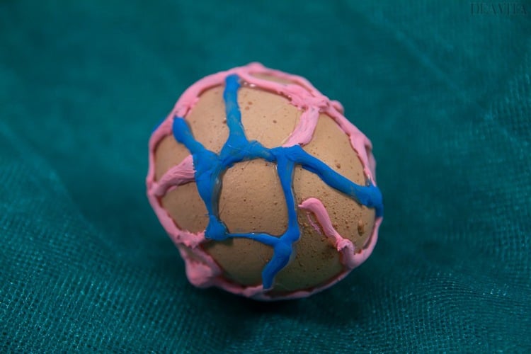 Ei mit 3D Deko schöne Strukturen mit Heißkleber schaffen