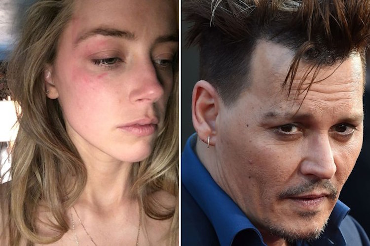 Amber Heard beschreibt neue brutale Details der Gewalt durch Johnny Depp
