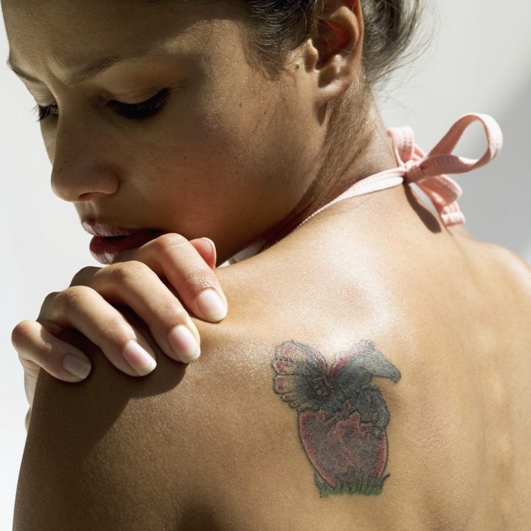 Tattooentfernung Laser Kosten Tattoo entfernen Methoden