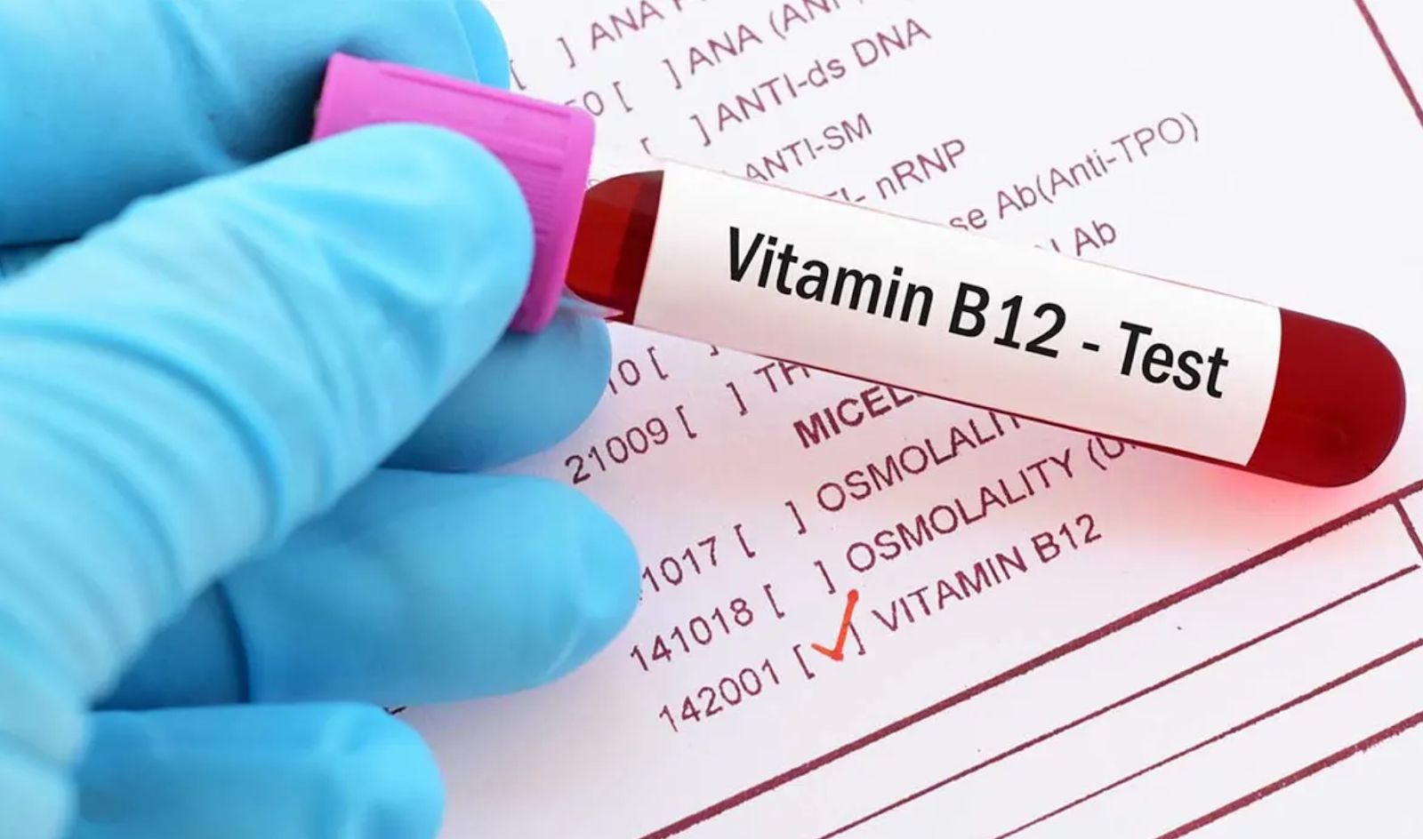 Vitamin B12 Tabletten Blut untersuchung Vitamin B12 Mangel Symptome