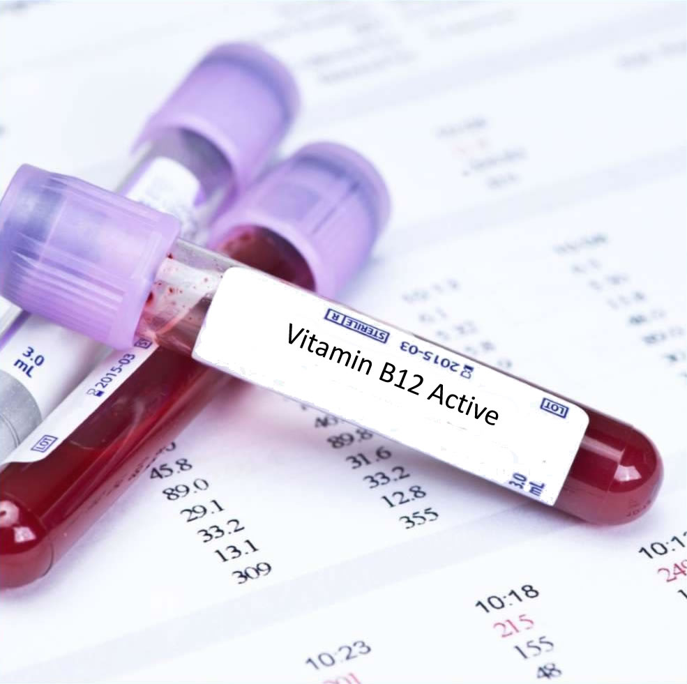 Vitamin B12 Untersuchung Bluttest grosses Blutbild kosten Hausarzt