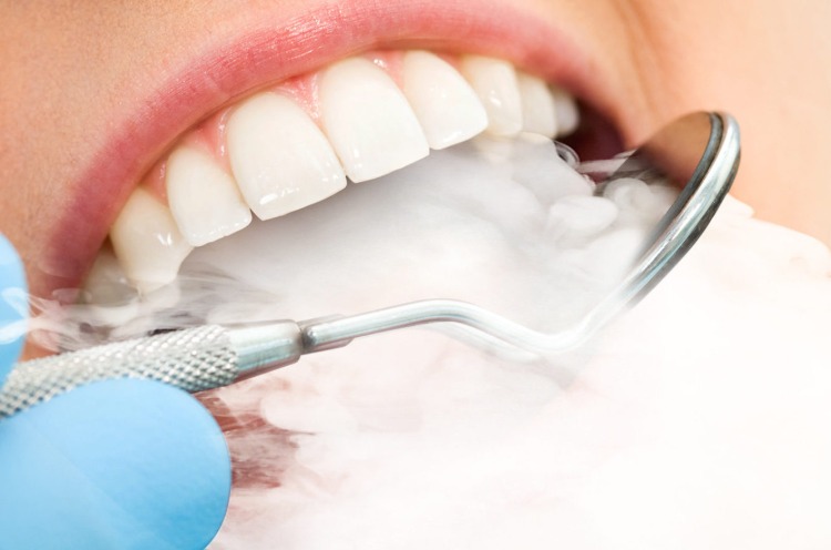 zigarettenrauch kommt aus dem mund vom patient beim zahnarzt