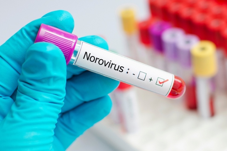 Noroviren im Sommer Schutzmaßnahmen Tipps