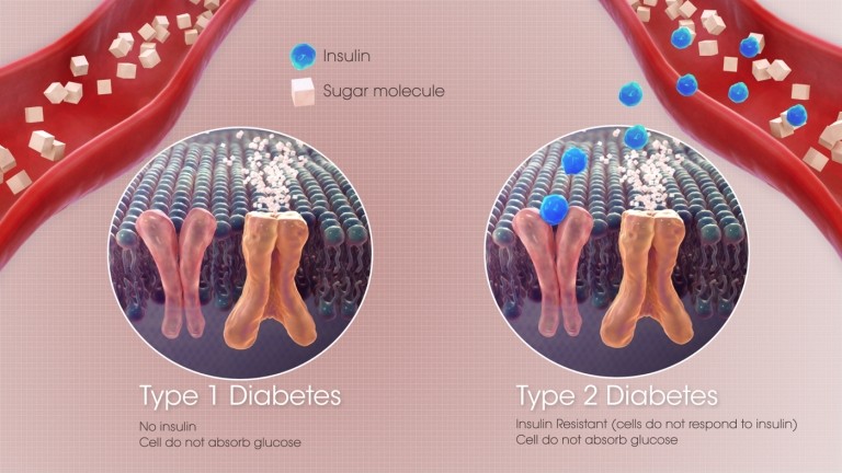 Warum verweigern Beta-Zellen die Freigabe von Insulin Forschung