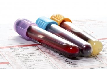 Blutwerte im Blutbild dienen zur Diagnose verschiedener Krankheiten