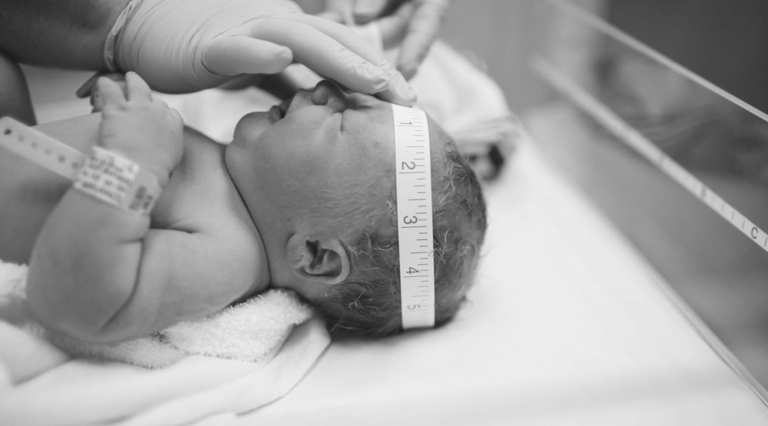 Der Kopfumfang vom Baby bei der Geburt wird gemessen, wie auch andere Werte