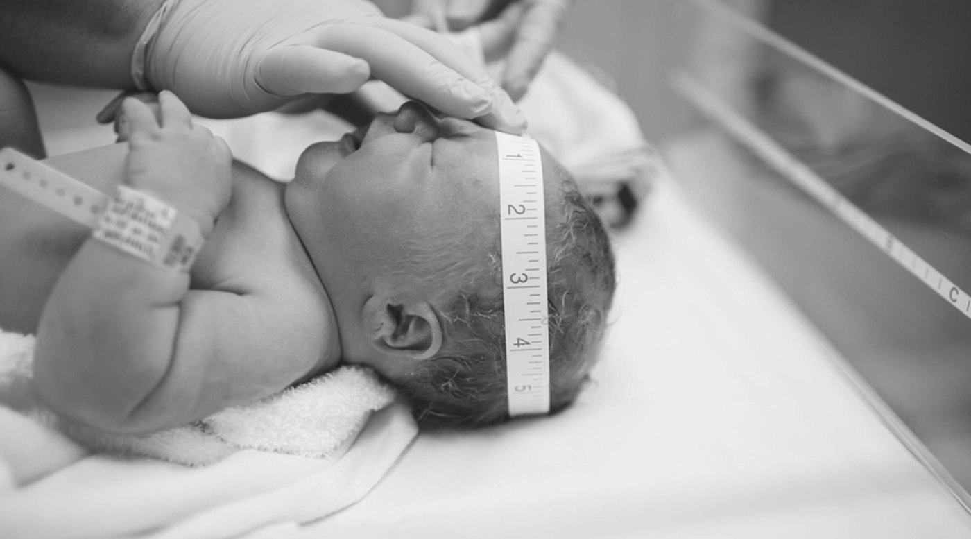 Der Kopfumfang vom Baby bei der Geburt wird gemessen, wie auch andere Werte