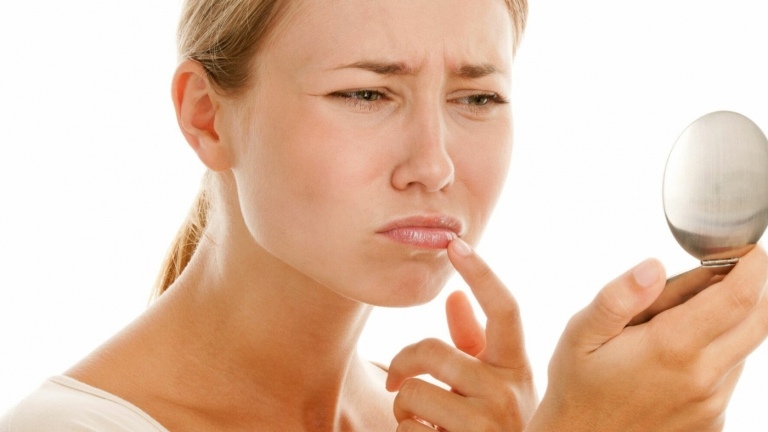 Der Virus bei Lippenherpes ist hochansteckend, deshalb ist gründliche Hygiene wichtig