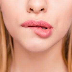 Lippenherpes und Hausmittel gegen Herpes - Was hilft und wie kann man sich schützen