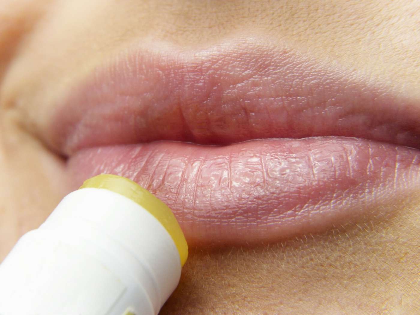 UV protection for lips and body is a herbal remedy for herpes simplex