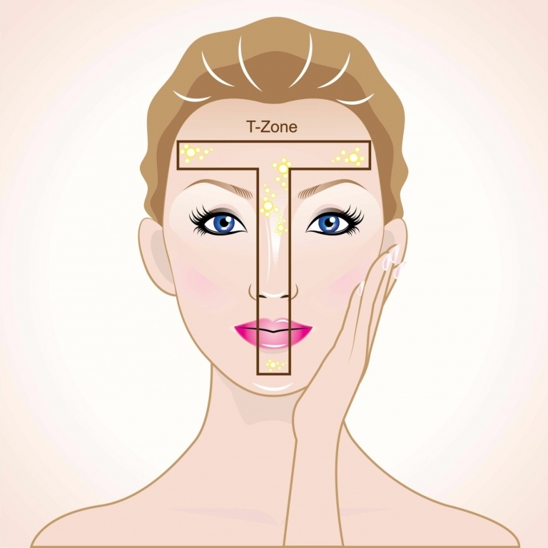 Die T-Zone ist der Bereich um die Nase und der Stirn und wird häufig von Pickel unter der Haut geplagt