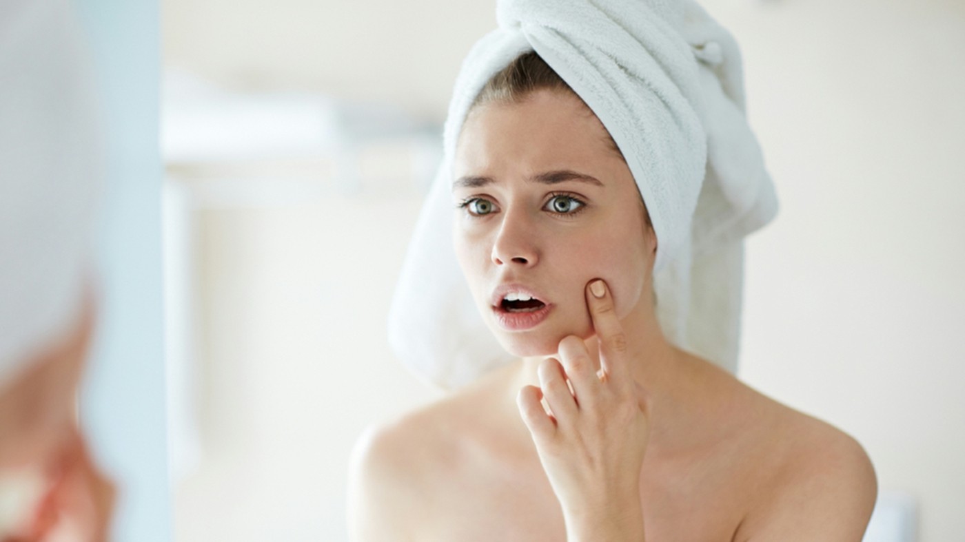Wann gehen Pickel von selbst weg - Interessante Informationen über Hautunreinheiten
