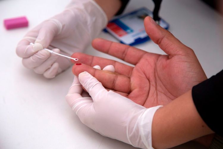 blutprobe aids hiv virus gesundheitsversorgung