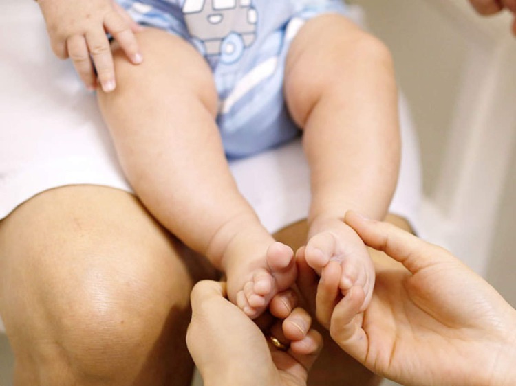 frau hält die beine von baby mit zika virus infiziert