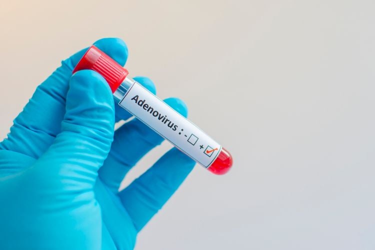 wissenschaftliche forschung adenovirus infektionen mib1 protein