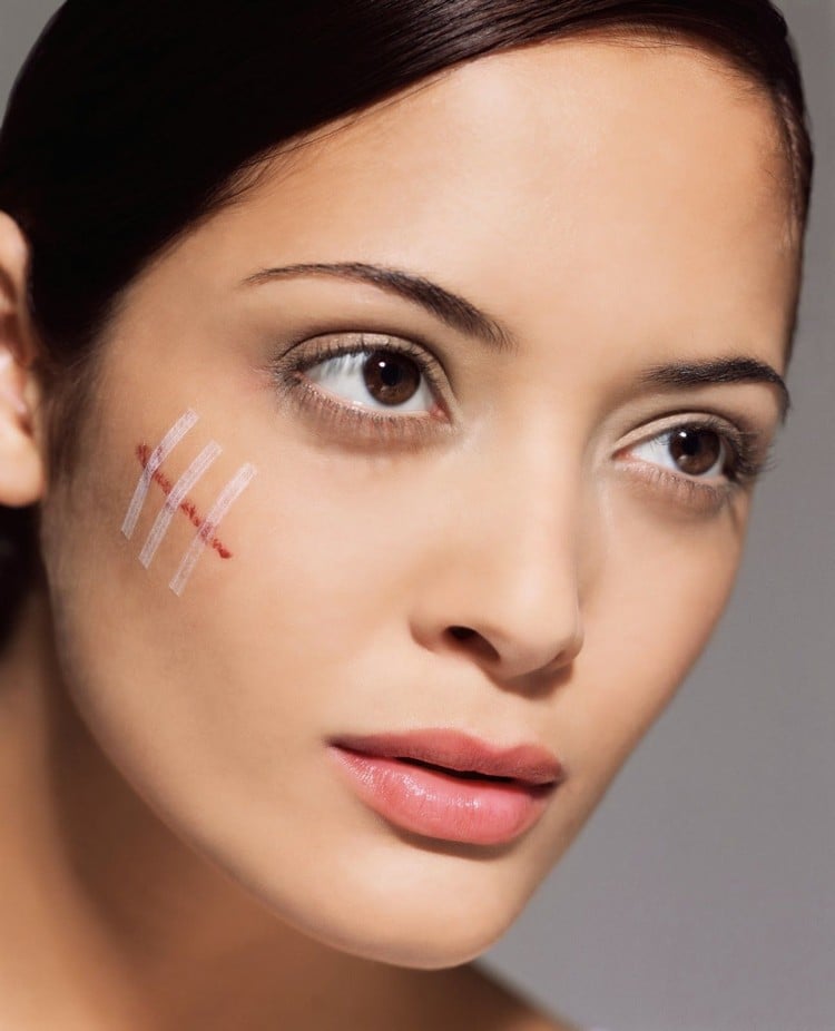 Narbenpflege im Gesicht heilen und welche narbenpflegeöle auftragen Tipps