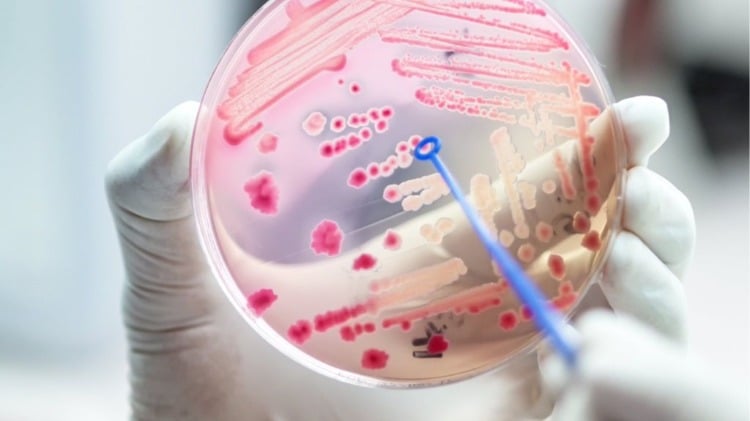 bakterien in reagenzglas verursachen sepsis infektion todesursachen
