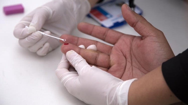 forschung von aids blutabnahme infizierter patient