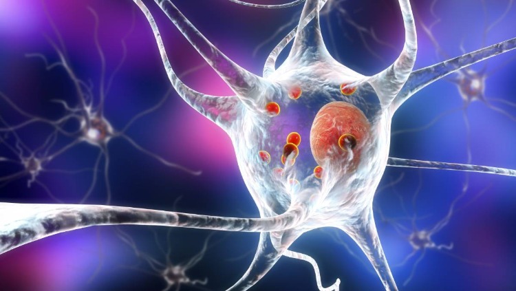 induzierte pluripotente stammzelle parkinson krankheit vorbeugen neuronale erkrankung