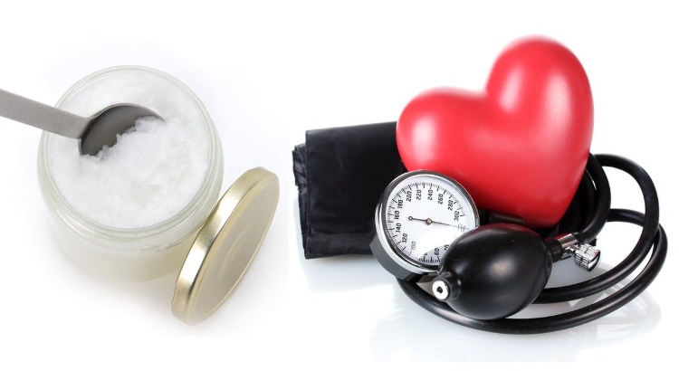 kokosöl gesund oder nicht herz-kreislauf-erkrankungen risiko hoher cholesterinspiegel