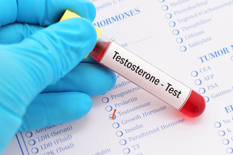 testosteron im blut testen hormon check
