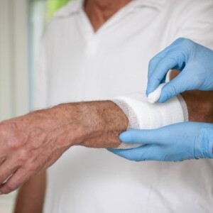 verbandsmull mit gummihandschuhen im krankenhaus auswechseln an arm von patient