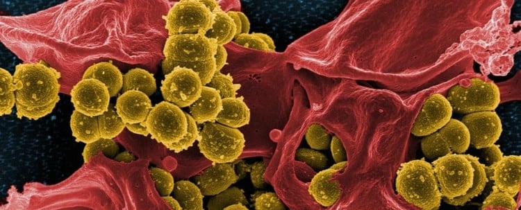Multiresistente Keime und Bakterien behandeln mit neuen Antibiotika