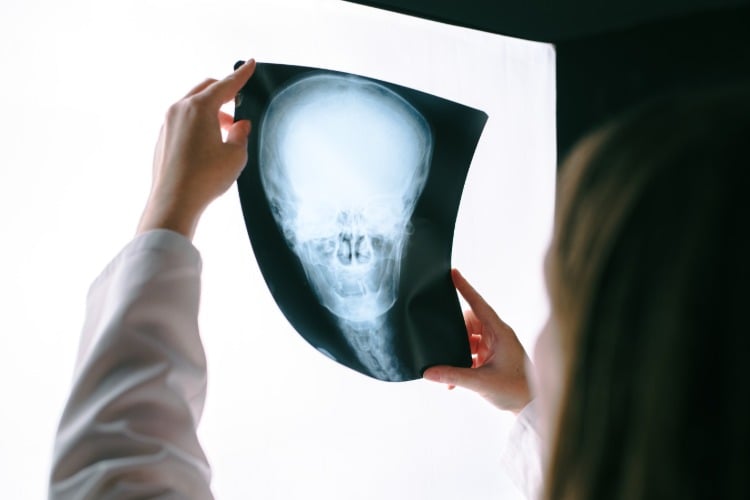 ärztin untersucht röntgenbild von hirntumor