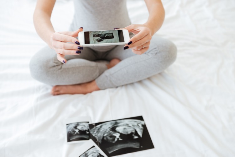 schwangere frau macht foto vom baby ultraschall