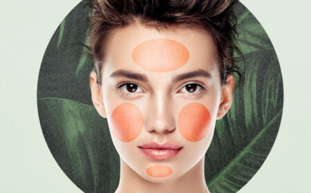 Ernährung bei Rosacea