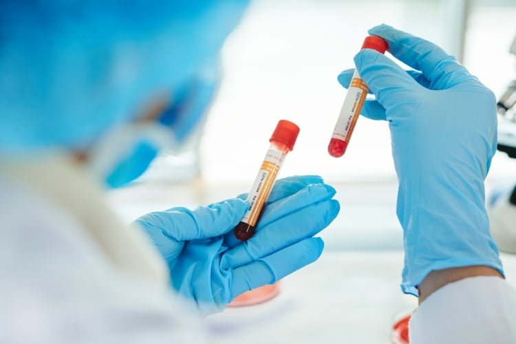 Mit Bluttest Krebs diagnostizieren - Forscher veröffentlichen Studienergebnisse