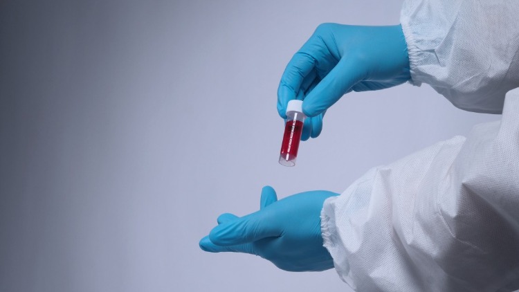 blutprobe antikörper test immun gegen coronavirus