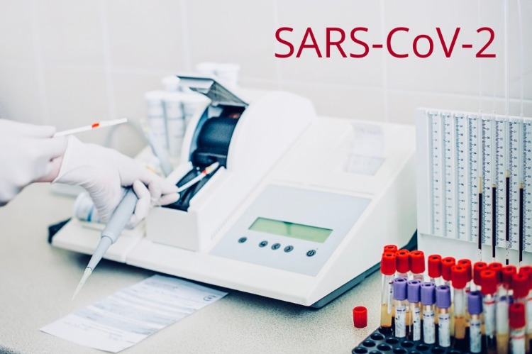 serumproben im labor testen auf coronavurs während covid 19 pandemie schnelltest auf sars cov 2