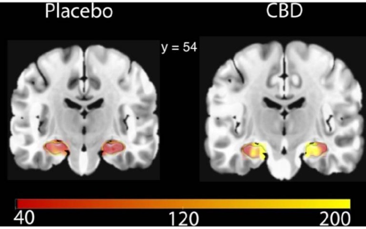 Cannabidiol CBD Wirkung auf Gehirn