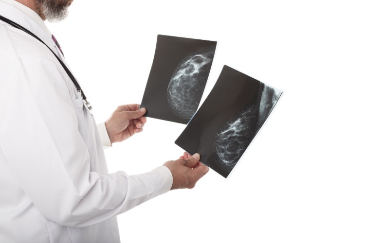 arzt untersucht röntgenaufnahmen von patientin mit brustkrebs