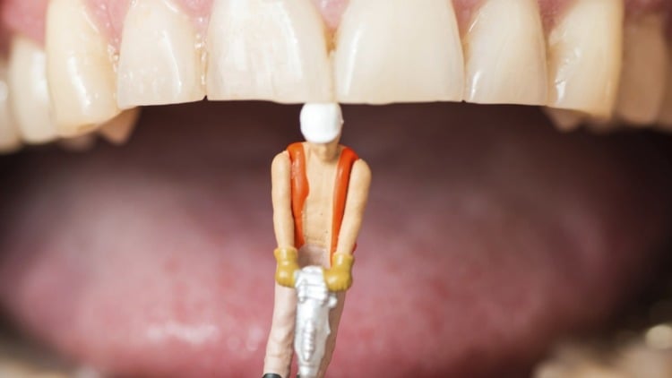 illustration of caries treatment by working person in the mouth
