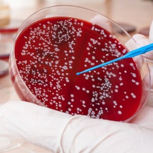 forscher untersucht blutprobe von krebs im alter durch reagenzglas im labor