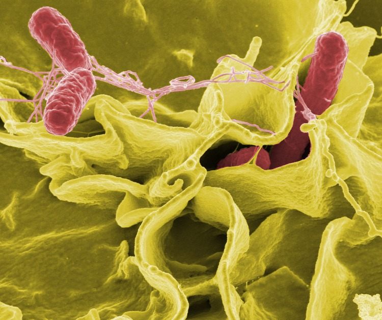 dangerous bacteria cause salmonella symptoms if the hygiene is poor