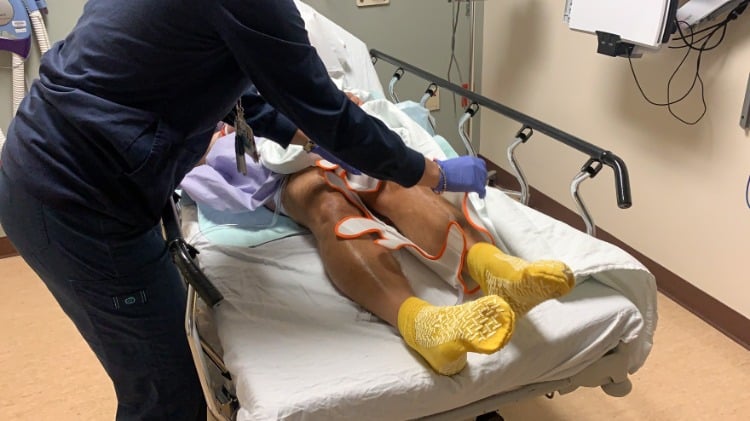 krankenschwester entfernt bandage vom bein eines patienten wegen blutgerinnsel