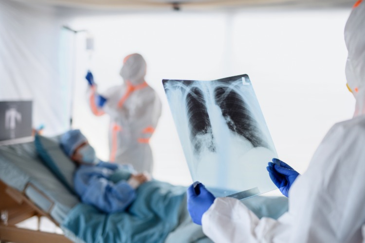 medizinische angestellten untersuchen patient mit covid 19 röntgenaufnahme der lunge